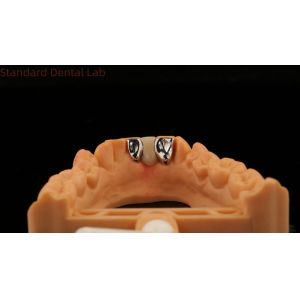 China Dental PFM Maryland Bridge High Esthetics FDA Certified With Vita Porcelian China Dental Lab on sale
