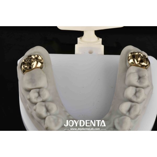 Buy Oral Rehabilitation With Dental Achieve Brighter And Healthier Smile at wholesale prices