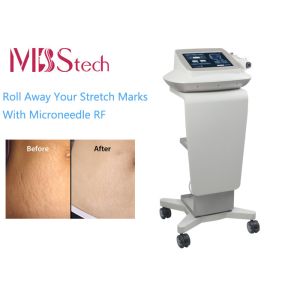 Fractional Radio Frequency Vacuum Microneedle Facial Machine