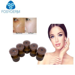 20mg/ml 5ml Mesotherapy Serum Whitening Meso Solution