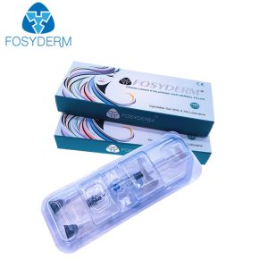 1.1ml Hyaluronic Acid Dermal Filler Lip Augmentation With Lidocaine