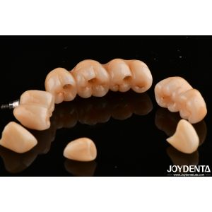 High Translucency Multilayered Full Contour Zirconia Natural looking 1200 HV