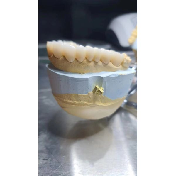 Multilayer Zirconia Dental Block Milling Disc 1200 Mpa For Aesthetic Restoration