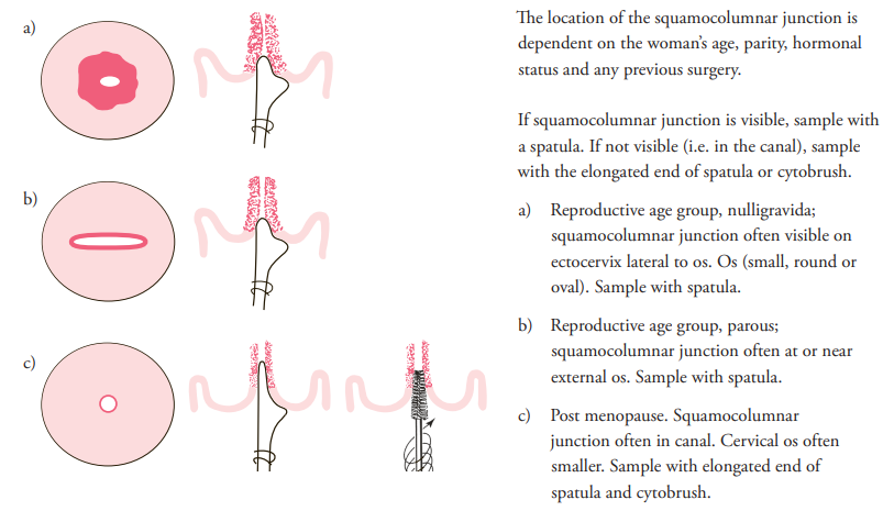PA66 Spatula Scraper Sterile Disposable Sampling Swab For Cell Pickup