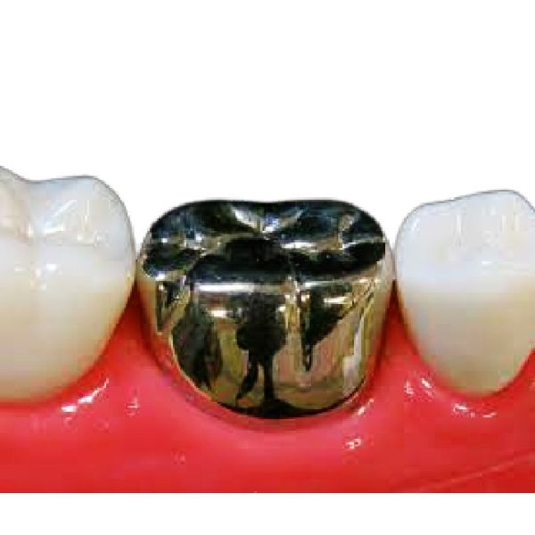 Buy High Hardness Gold Implant Crown Precious Metal Crown Corrosion Resistance at wholesale prices