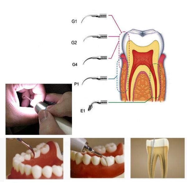A8 Piezo Dental ultrasonic scaler with water tank detachable handpiece