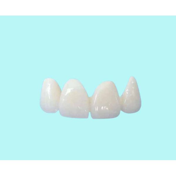 Easy Cleaning All Ceramic Crowns Transparent Natural Shade Customizable