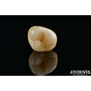 Dental Multilayer Full Zirconia Crowns And Bridges High Translucent Natural