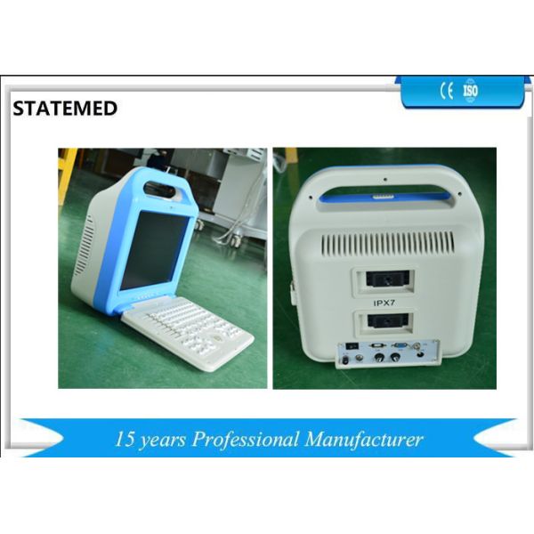 Customized Clear Image Black / White Ultrasound Scanner Onvex / Linear Scanning