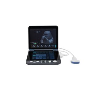 Quality Digital Portable Mobile Laptop Ultrasound Scanner With 12-inch LED Display &amp; 9.7-inch Touch Screen for sale