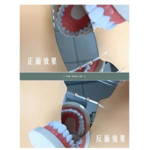 Dental Double Side Orthodontic Instrument SS Photograph Mirror