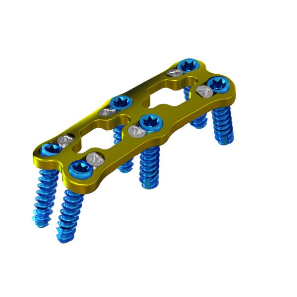 Buy Titanium Vertebra Spinal Anterior Cervical Fixation For Surgery at wholesale prices