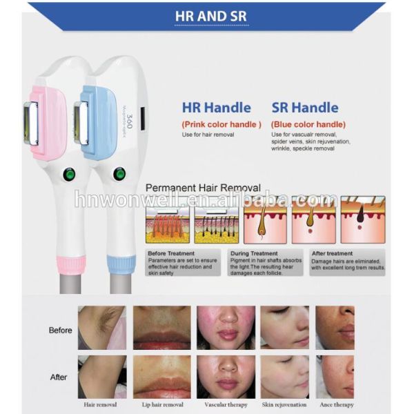 Super Quality Unique SHR IPL+Yag Laser+Fractional RF 4 in1 best beauty equipment