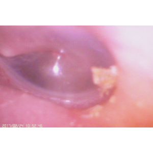 Mini Portable Digital Video Otoscope Record Photographs / Videos For Ear Nose