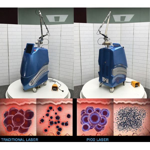 Buy Dermatologist Use Fda Approved Tattoo Removal Pico Machine Price at wholesale prices