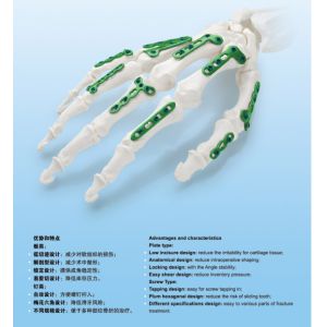 Mini Straight Metacarpal Plates HC2.7mm Plate And Screw 6 7 8 Holes