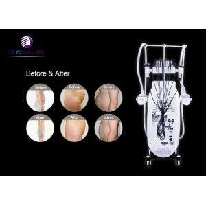 Fat Freezing Cavitation Weight Loss Machine 40KHz Cavitation Frequency US09S