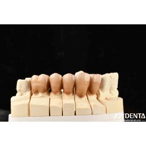 Bionic Development Leaves And Distinct Layers Of Zirconia All-Ceramic