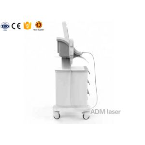 Effective Hifu Ultrasound Facelift Machine With No Postoperative Rest Time