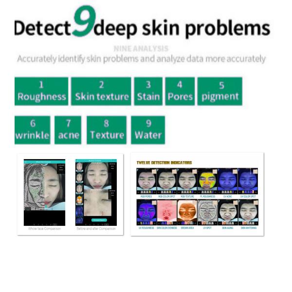 Buy 3D Digital Observer Facial Skin Scanner Analyzer Diagnosis Machine at wholesale prices