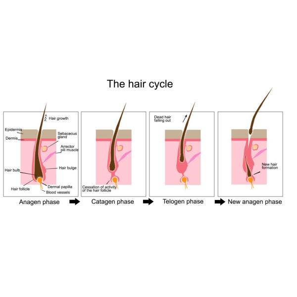 Mutifunctional Ipl OPT SHR Hair Removal Machine Beauty Salon With AFT Technology