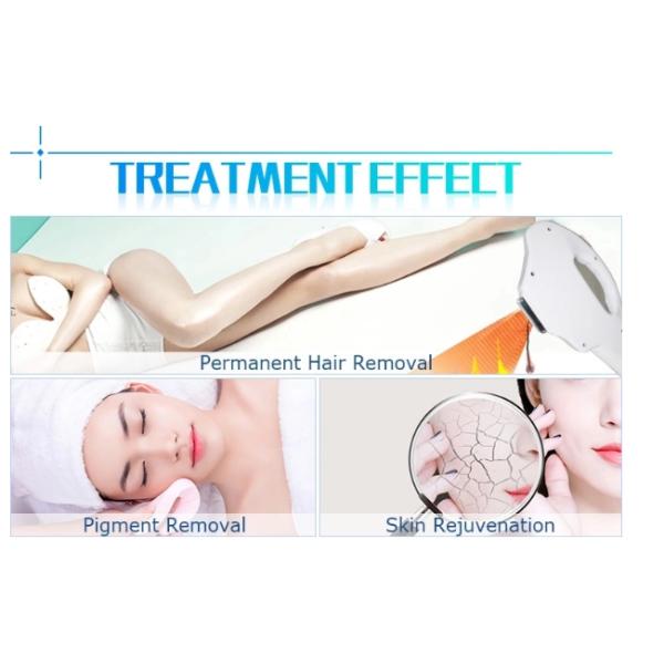 OPT 3 In 1 SHR Opt Shr Laser Ipl Machine Hair Removal Tattoo Removal Device