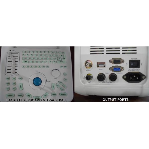 4d Ultrasound Machine Portable Ultrasound Scanner With 120G Capacity 4800 Frames