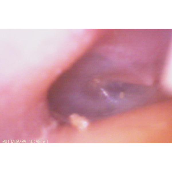 3.5 Inch LCD Digital Video Otoscope Camera For Ear Drum Perforation Inspection