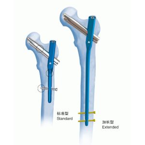 China Orthopedics Titanium Gamma Interlocking Nail Ⅳ PFN on sale