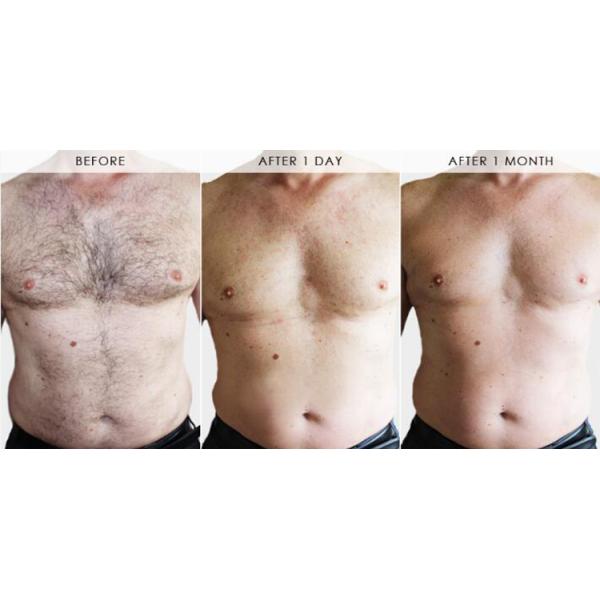 Hair Removal Laser Beauty Machine 808 High Power 2 Spot Size In 1 Handpiece