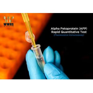 Inflammation IVD POCT Rapid Quantitative Test Kit One Step Assay
