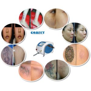 2000W 755nm Picosecond Laser Aesthetic Equipment