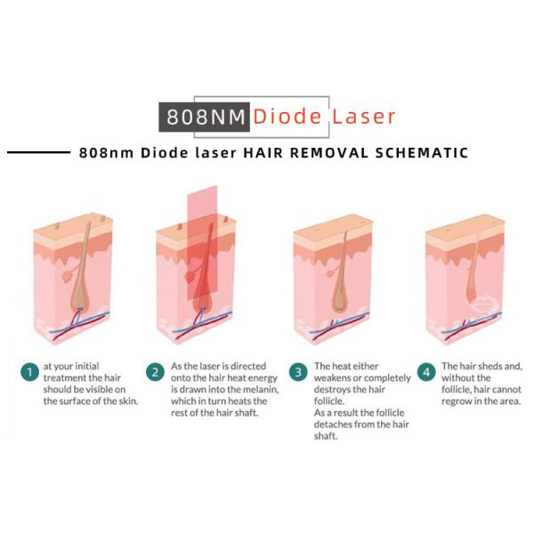 808nm Diode Laser Hair Removal Machine 2000W for Salons