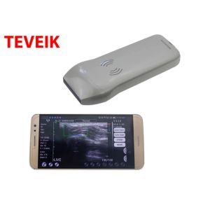 Portable Wireless Ultrasound Probe Medical Ultrasonic Convex Probe Doppler