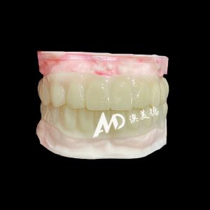 PMMA Hollow Temporary Bridges for Implant Provisional Cases
