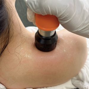 21HZ Shockwave Therapy Machine ESWT Acoustc Shock Wave Equipment Relieves