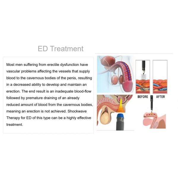 Multifunction Smart Tecar Therapy Machine Shockwave ED Treatment