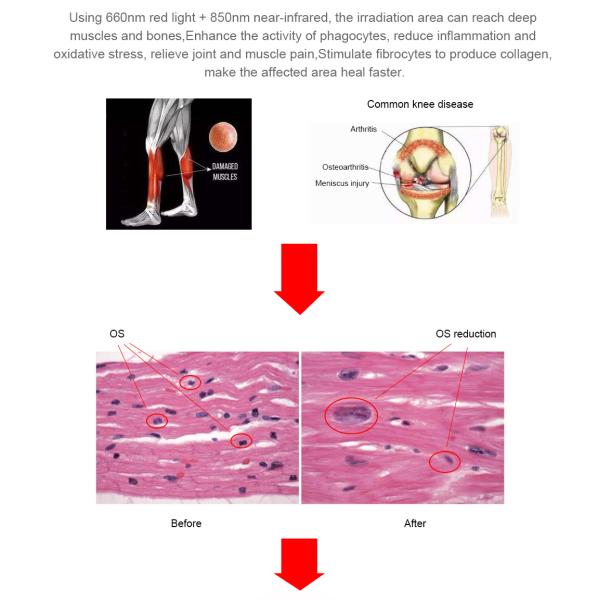 Bio Laser Infrared Light Therapy Bed Full Body Photobiomodulation Panel