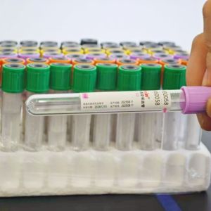 China Purple Cap Vacuum Blood Collection Tube CF-DNA on sale