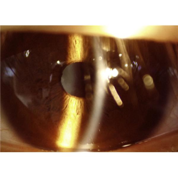 Digital Hand-held Slit Lamp Opthalmology Equipment Used For Anterior Segment Imaging 10X Magnification 16MP Resolution