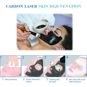 CE approval hot selling most popular pigment and tattoo removal Pico laser