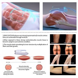 4 Handles Ems Sculpting Machine With 15.6”Touch Screen