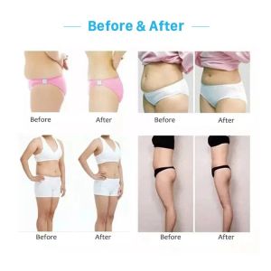 slimming massage ultrasonic beautiful multifunctional beauty body weight