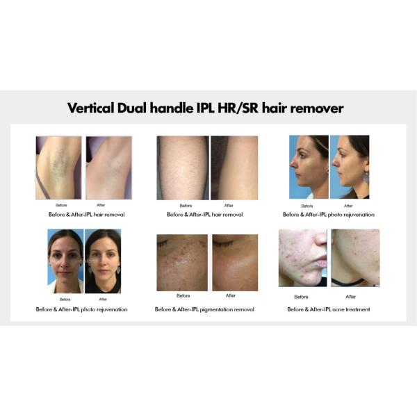 Professional Permanent IPL OPT Epilator Skin Rejuvenation Hair Removal Machine