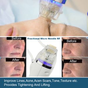 Portable Professional Fractional Rf Microneedling Machine Radio Frequency Gold