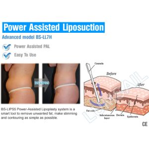 Safe Hip Power Assisted Surgical Liposuction Machine High Fluency For Fast Fat