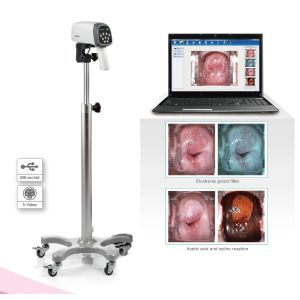EDAN C3A&C6A Video Colposcope
