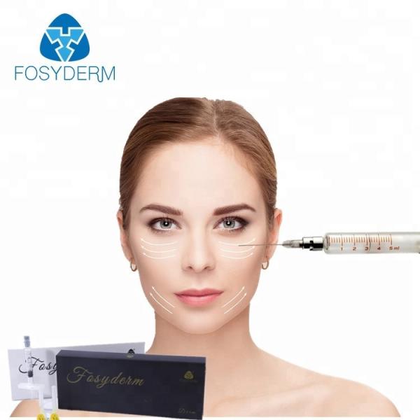 Buy Fosyderm Sodium Hyaluronic Acid Dermal Filler For Cosmetic Surgery Derm 1ml at wholesale prices