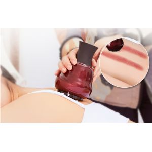 Portable Beauty Vacuum Massage Therapy Equipment Negative Pressure Gravitation