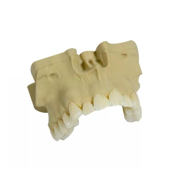 Buy Smooth Surface PFM Dental Crown High Strength Realistic Appearance at wholesale prices